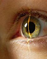 от чего появляется глаукома