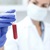 Биохимический анализ крови – нормы, значение и расшифровка